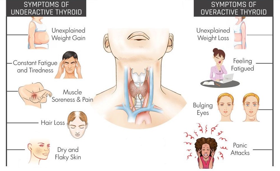 maladie liée à la thyroïde